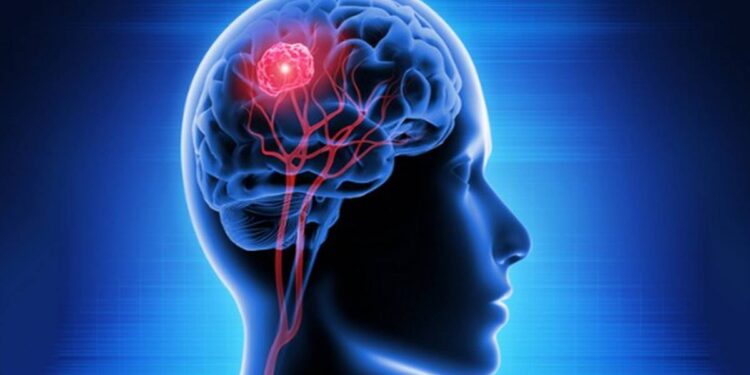 Social Isolation And Reduced Brain Volume Are Aelated In New Research